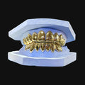 10k Gold Grillz