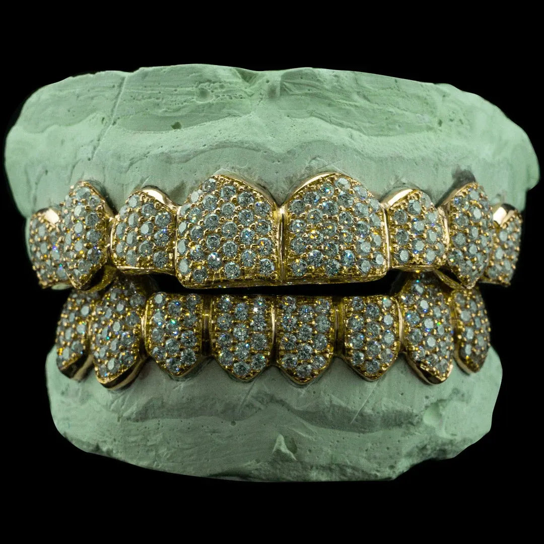 Moissanite Grillz